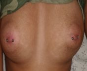 I think my nipple is not well pierced? I got them Monday and they looked fine to me till I saw pictures of other nipple piercings. The thing is I got a flat nipple so I don't know if it should look like this. from pamela mondal nipple